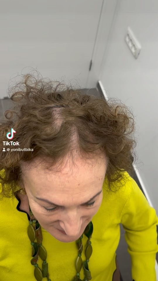 מילוי שיער