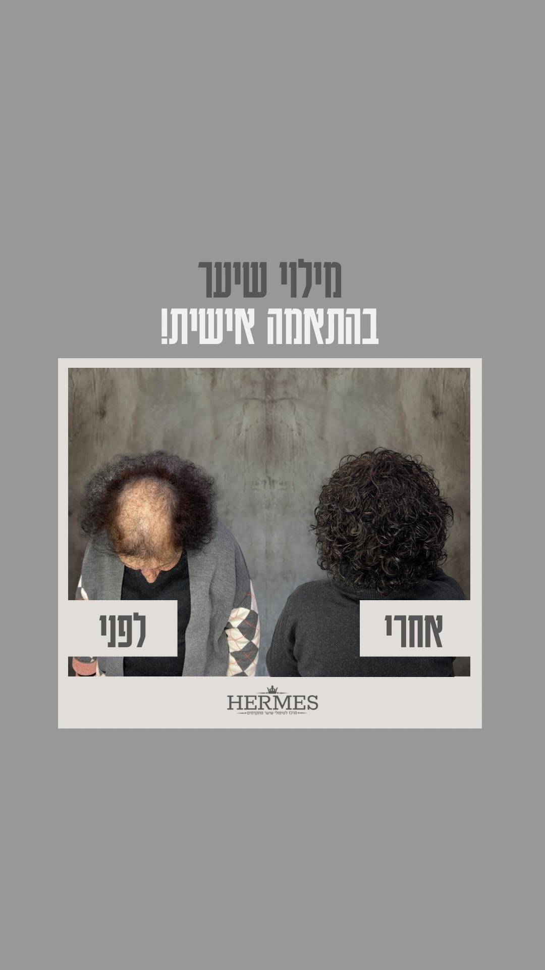 מילוי שיער