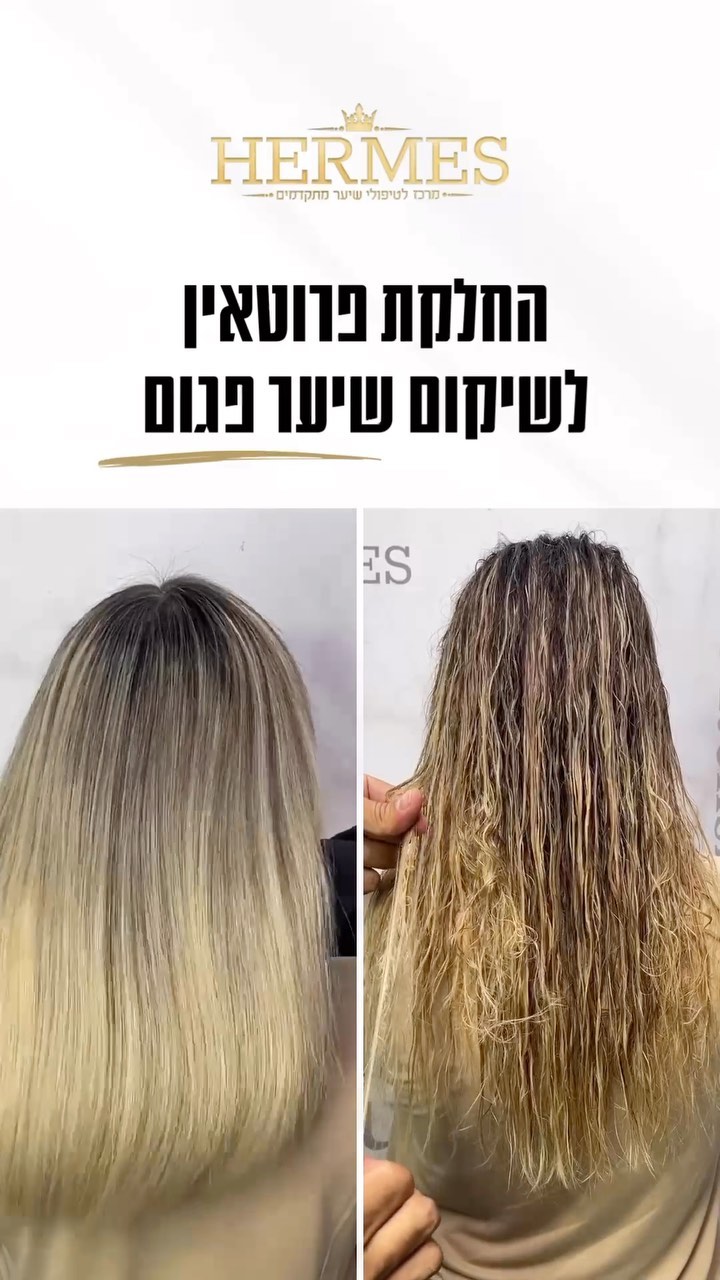 טיפול פרוטאין